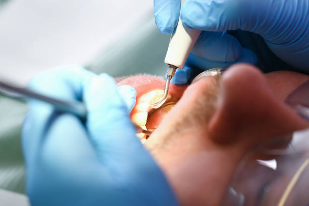 Best Orthodontic Emergency Dentist in Old Saybrook Center, CT