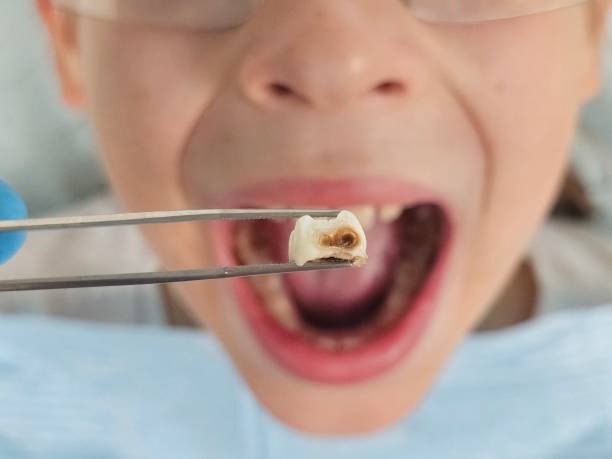 Best Weekend Emergency Dentist in Old Saybrook Center, CT